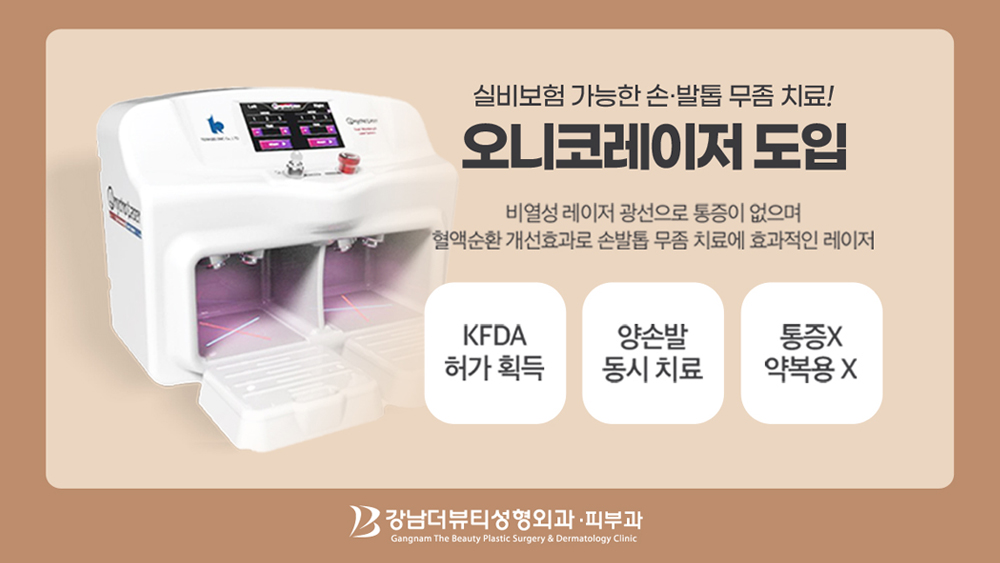 팝업1